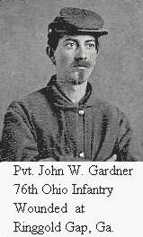 Pvt. Gardner 76th Ohio